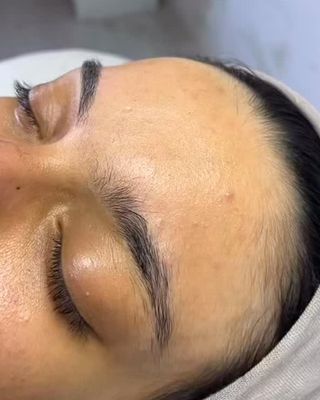 Kaş alımı sonrası