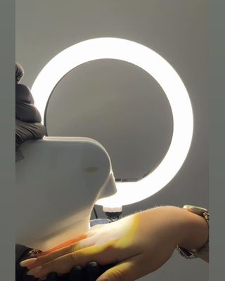 Halka ışık altında ele lazer epilasyon uygulaması